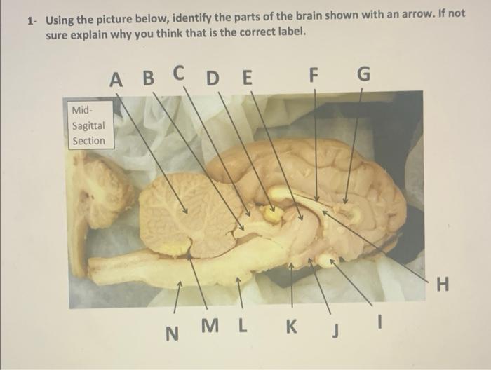 1 Using The Picture Below Identify The Parts Of The Brain Shown With An Arrow If Not Sure Explain Why You Think That 1