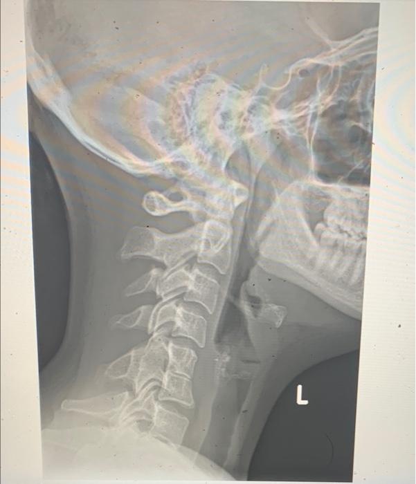 L 0 1 L Case History A 28 Year Old Female Presents With Neck Pain And History Of Migraines 10 L 1