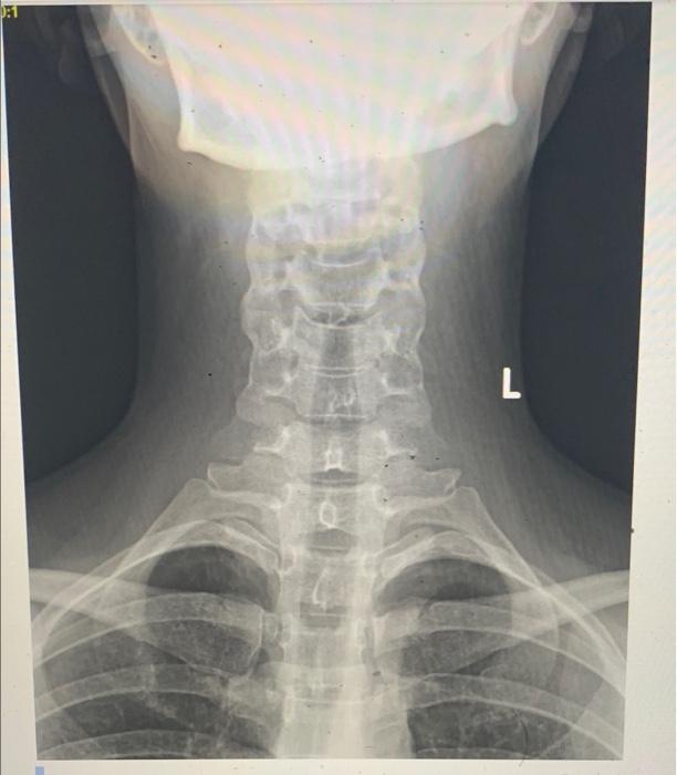 L 0 1 L Case History A 28 Year Old Female Presents With Neck Pain And History Of Migraines 10 L 2