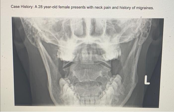 L 0 1 L Case History A 28 Year Old Female Presents With Neck Pain And History Of Migraines 10 L 3