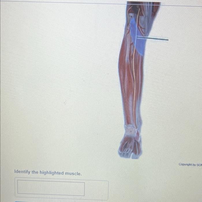 The Highlighted Muscle Originates From Which Bone Submit Request Answer Tva 16 Life Size Muscle Terse 27 Part 30 Sci 5