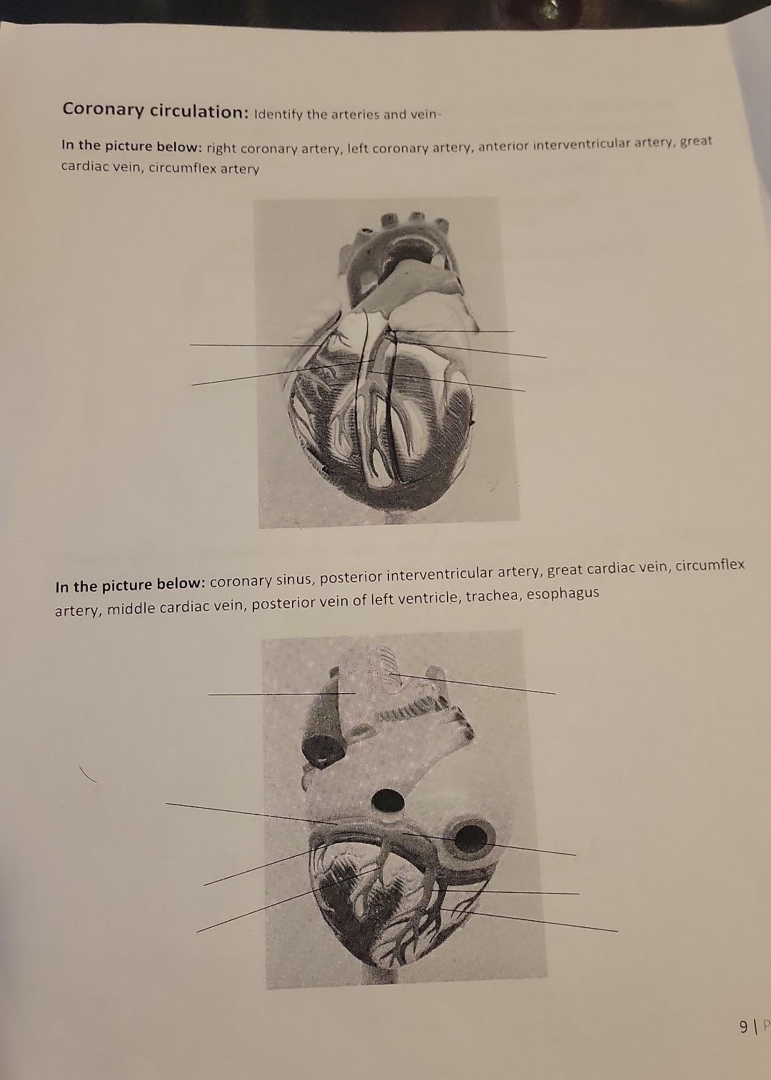 Coronary Circulation Identify The Arteries And Vein In The Picture Below Right Coronary Artery Left Coronary Artery 1