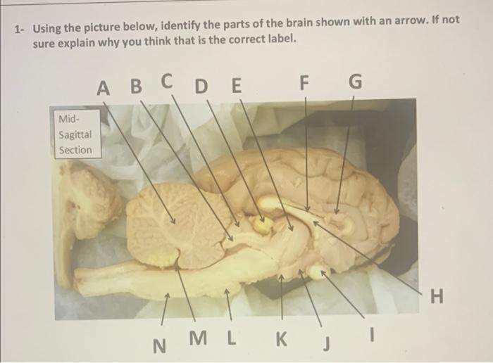 1 Using The Picture Below Identify The Parts Of The Brain Shown With An Arrow If Not Sure Explain Why You Think That 1