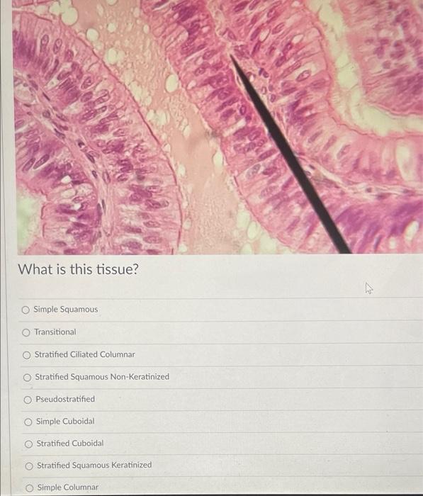 What Is This Tissue Simple Cuboidal Stratified Squamous Keratinized Pseudostratified Stratified Squamous Non Keratinize 2