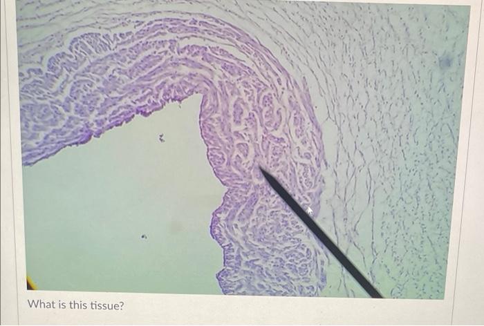 What Is This Tissue Simple Cuboidal Stratified Squamous Keratinized Pseudostratified Stratified Squamous Non Keratinize 3