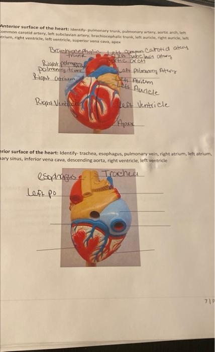 Anterior Surface Of The Heart Identify Pulmonary Trunk Pulmonary Artery Aortic Arch Left Common Carotid Artery Left 1