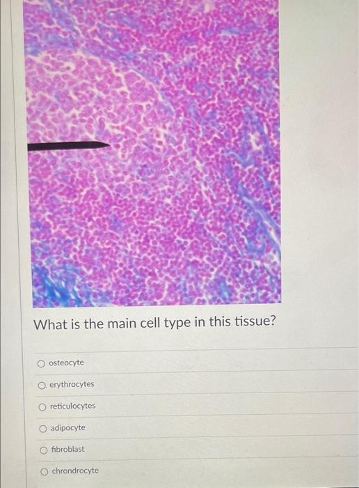 What Is The Main Cell Type In This Tissue Oosteocyte O Erythrocytes Reticulocytes O Adipocyte Fibroblast Chrondrocyte 2