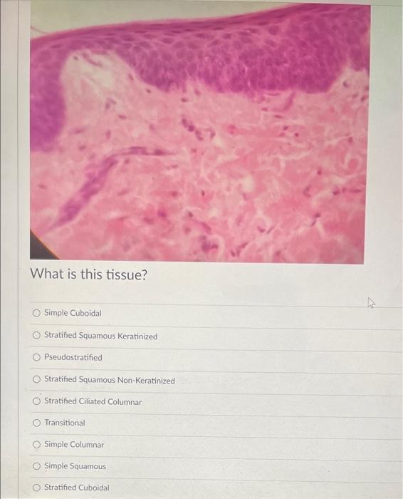 What Is The Main Cell Type In This Tissue Oosteocyte O Erythrocytes Reticulocytes O Adipocyte Fibroblast Chrondrocyte 4