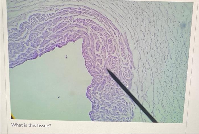 What Is The Main Cell Type In This Tissue Oosteocyte O Erythrocytes Reticulocytes O Adipocyte Fibroblast Chrondrocyte 5