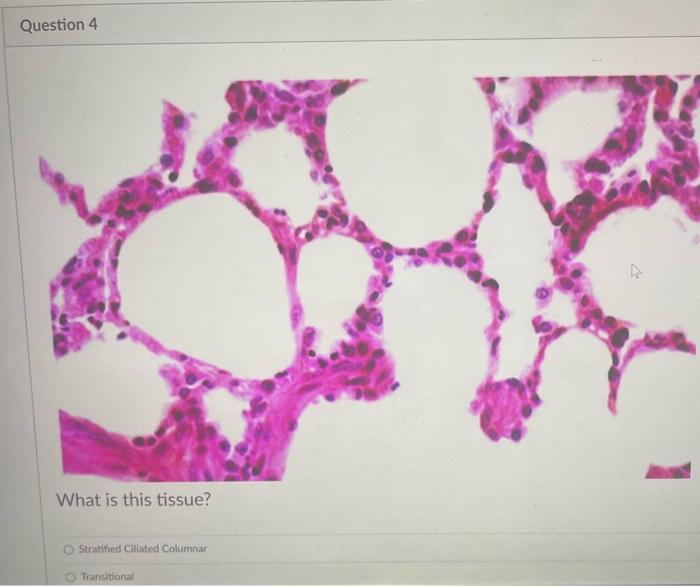 What Is The Main Cell Type In This Tissue Oosteocyte O Erythrocytes Reticulocytes O Adipocyte Fibroblast Chrondrocyte 8