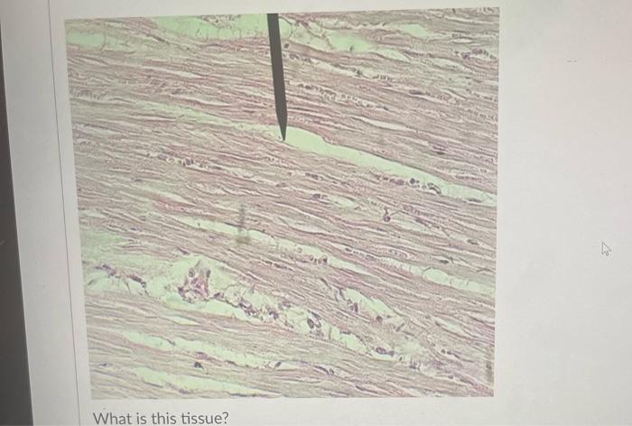 What Is The Main Cell Type In This Tissue Oosteocyte O Erythrocytes Reticulocytes O Adipocyte Fibroblast Chrondrocyte 9