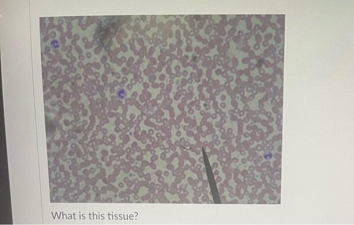 What Is The Main Cell Type In This Tissue Oosteocyte O Erythrocytes Reticulocytes O Adipocyte Fibroblast Chrondrocyte 11
