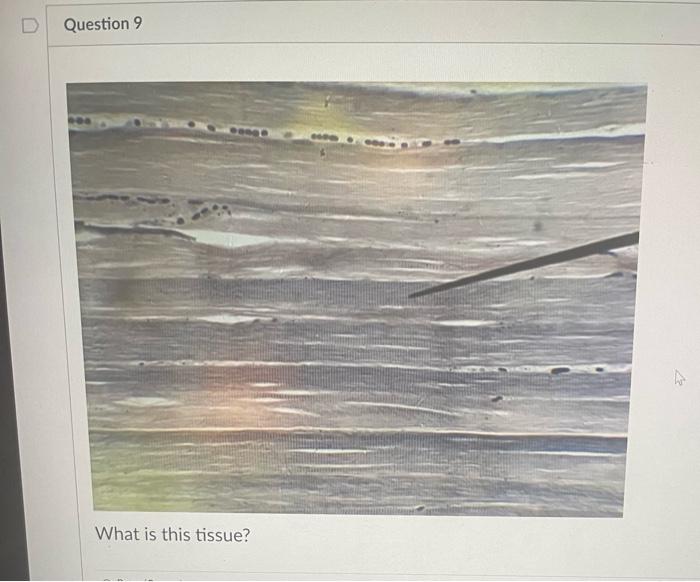 Question 9 What Is This Tissue Question 10 What Is This Tissue T Question 11 What Is This Tissue What Is This Tiss 1