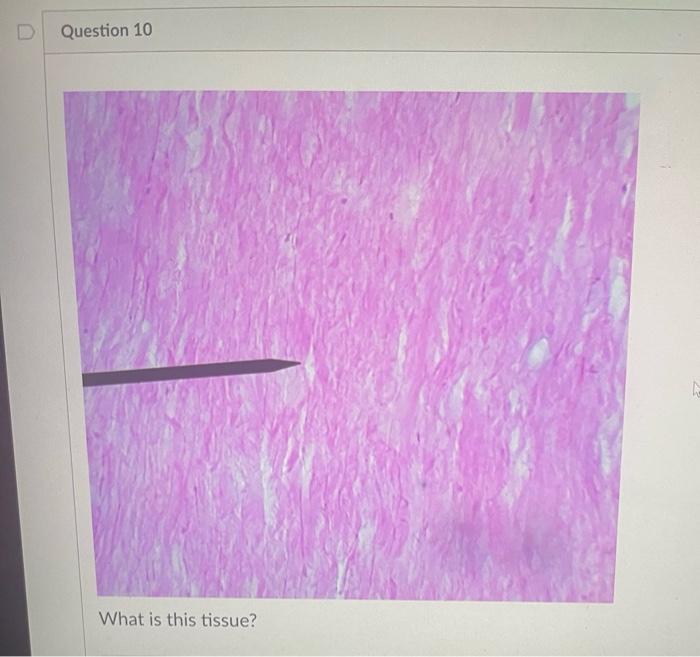 Question 9 What Is This Tissue Question 10 What Is This Tissue T Question 11 What Is This Tissue What Is This Tiss 2