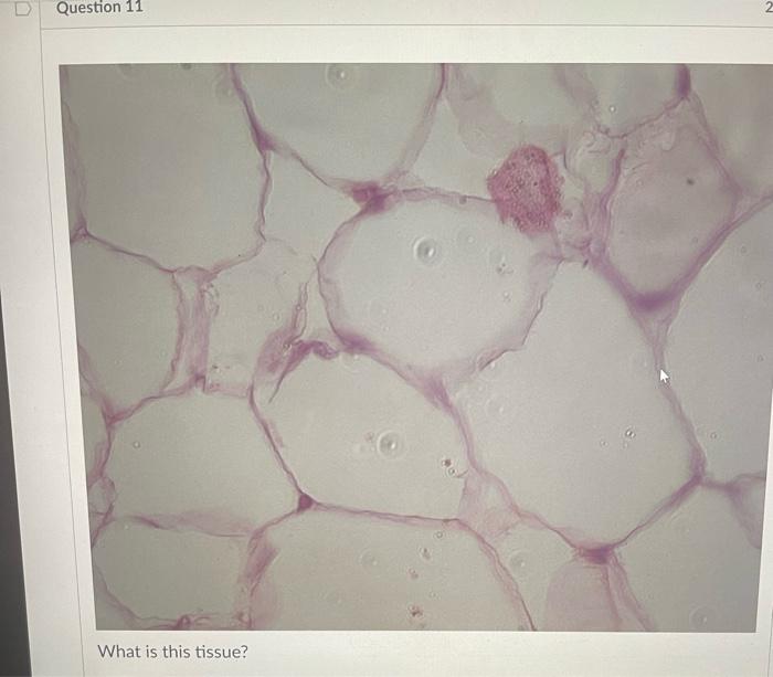Question 9 What Is This Tissue Question 10 What Is This Tissue T Question 11 What Is This Tissue What Is This Tiss 3