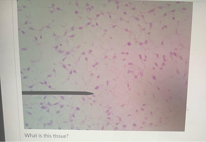 Question 9 What Is This Tissue Question 10 What Is This Tissue T Question 11 What Is This Tissue What Is This Tiss 4