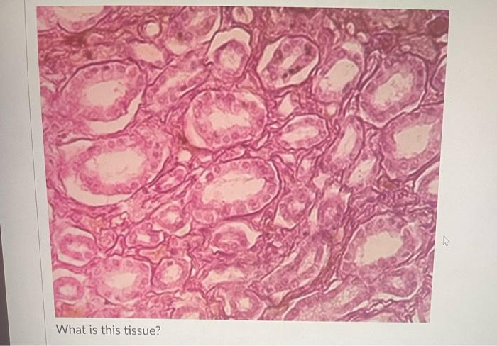 Question 9 What Is This Tissue Question 10 What Is This Tissue T Question 11 What Is This Tissue What Is This Tiss 5