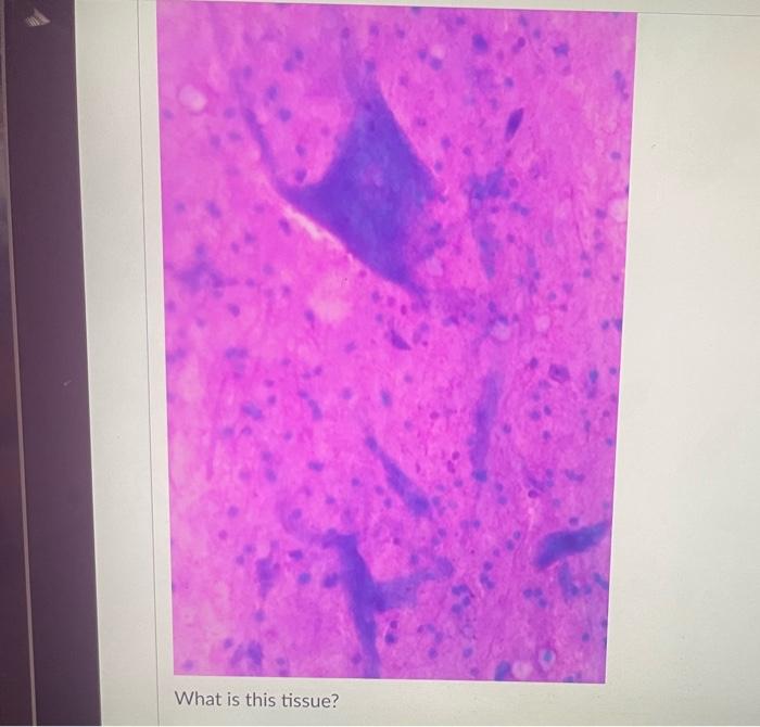 Question 9 What Is This Tissue Question 10 What Is This Tissue T Question 11 What Is This Tissue What Is This Tiss 6
