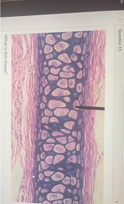 Question 9 What Is This Tissue Question 10 What Is This Tissue T Question 11 What Is This Tissue What Is This Tiss 7