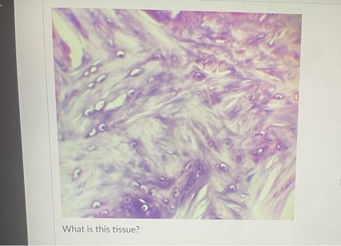 Question 9 What Is This Tissue Question 10 What Is This Tissue T Question 11 What Is This Tissue What Is This Tiss 9