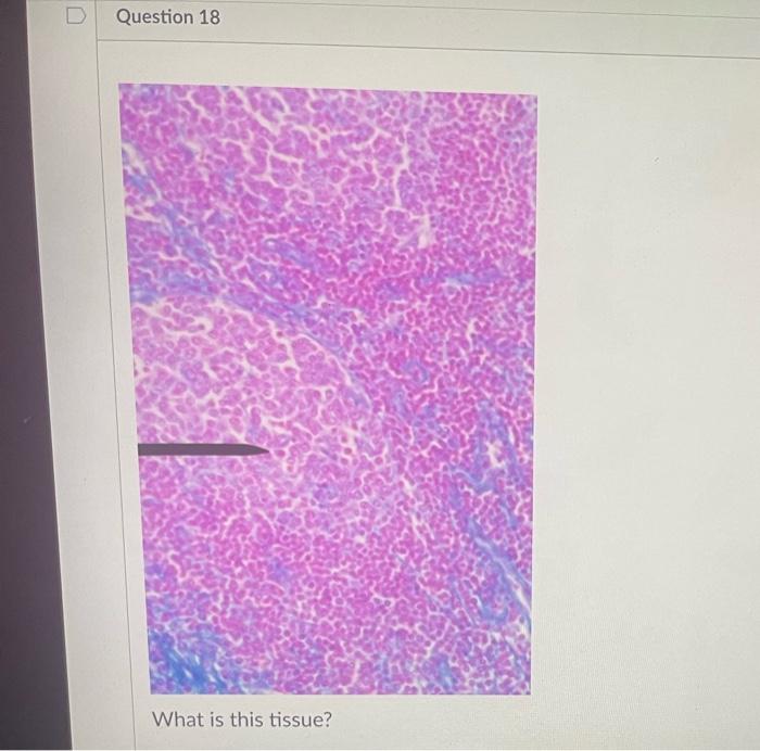 Question 9 What Is This Tissue Question 10 What Is This Tissue T Question 11 What Is This Tissue What Is This Tiss 10