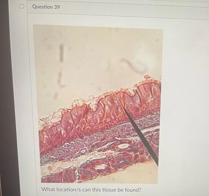 What Is The Function Of This Tissue Question 31 What Is The Function Of This Tissue Newall Question 32 What Is The F 11