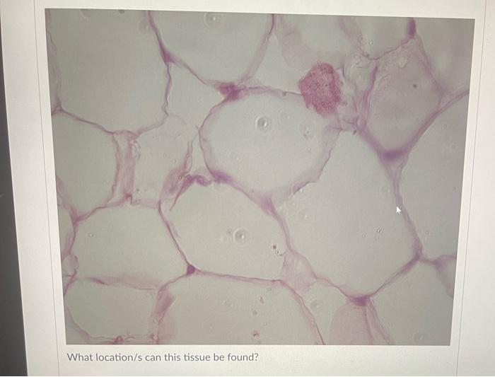 Question 40 What Location S Can This Tissue Be Found Vela What Location S Can This Tissue Be Found 3 What Location S 4