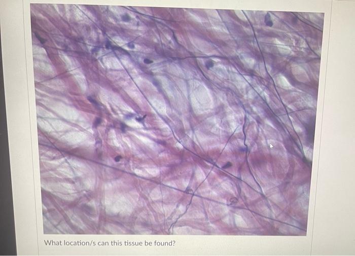 Question 40 What Location S Can This Tissue Be Found Vela What Location S Can This Tissue Be Found 3 What Location S 5