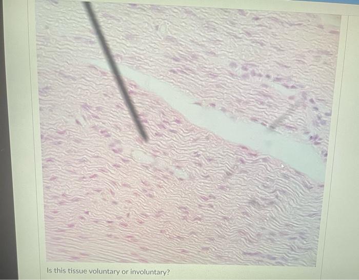 Question 40 What Location S Can This Tissue Be Found Vela What Location S Can This Tissue Be Found 3 What Location S 8
