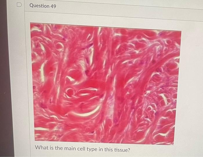 Question 40 What Location S Can This Tissue Be Found Vela What Location S Can This Tissue Be Found 3 What Location S 10