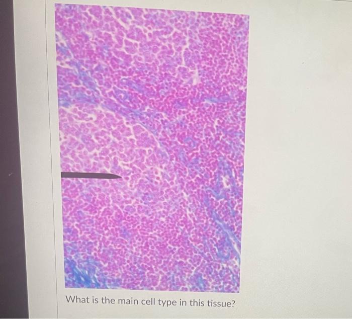 Question 40 What Location S Can This Tissue Be Found Vela What Location S Can This Tissue Be Found 3 What Location S 11