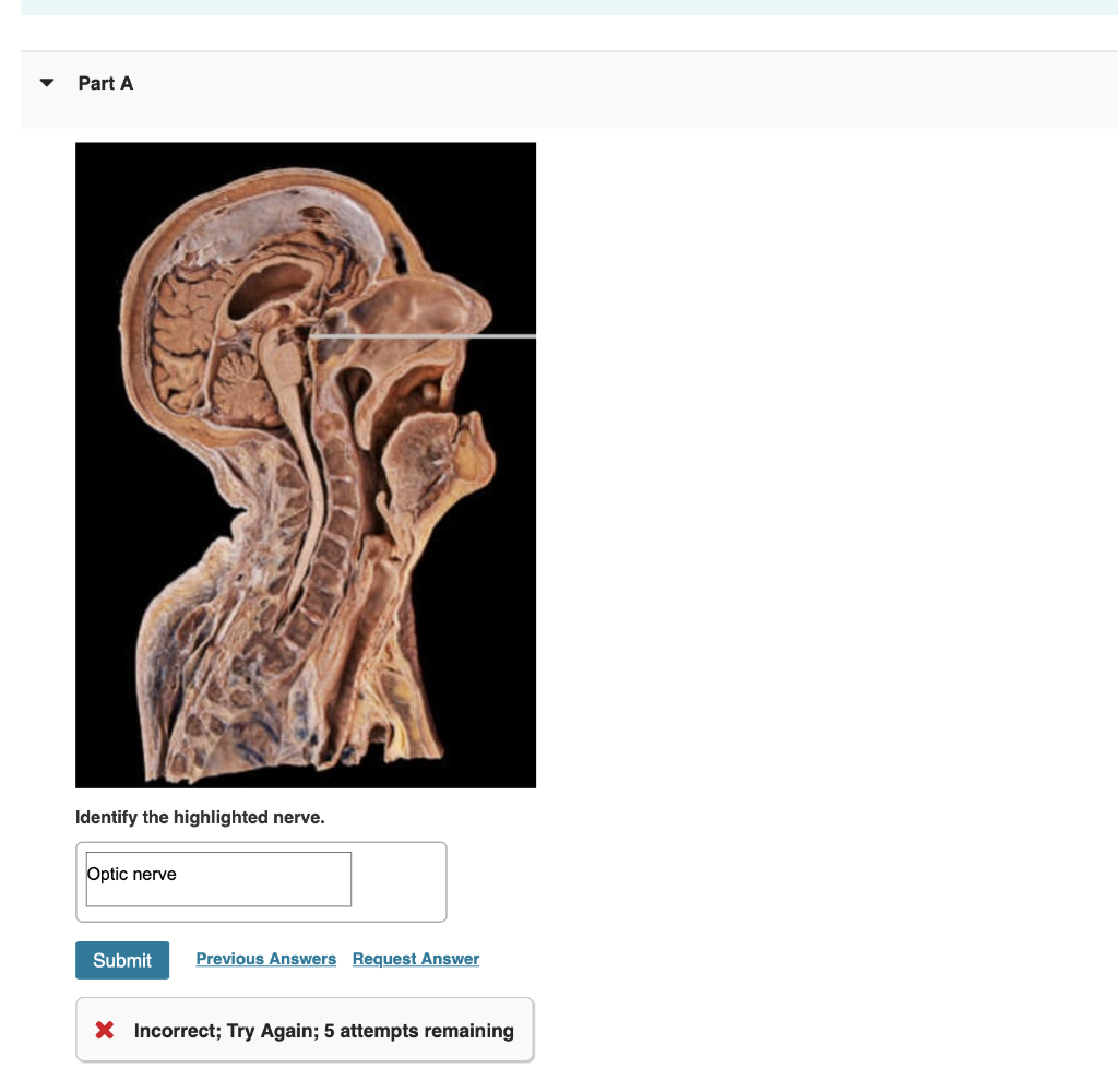 Part A Identify The Highlighted Nerve Optic Nerve Submit Previous Answers Request Answer X Incorrect Try Again 5 Atte 1