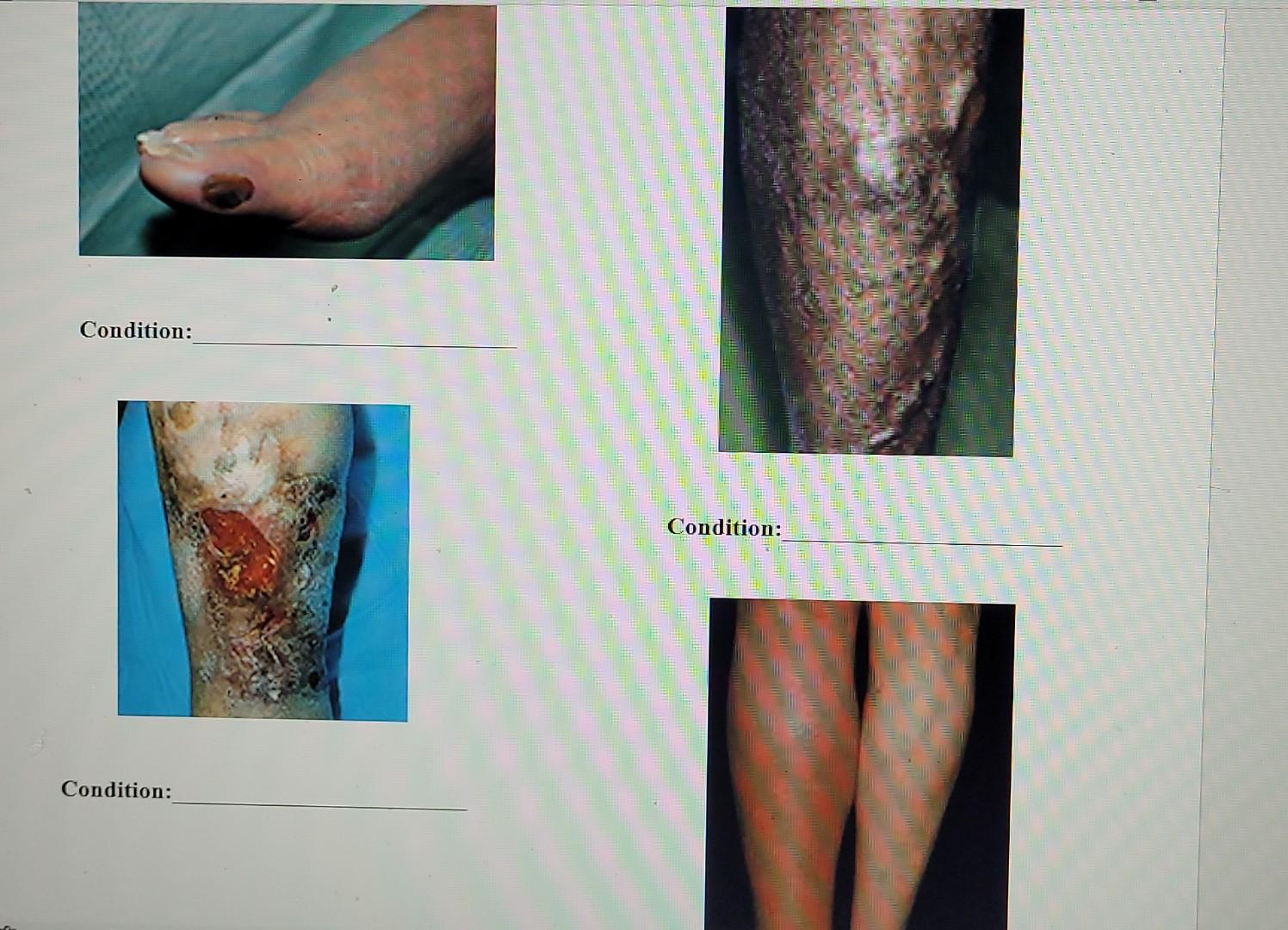 Condition Condition Condition 4 4 4 4 49 24 14 100 1