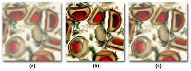 4 The Panel Below Shows Three Different Qualities Of The Same Image One Is Good And The Other Two Are Poor Identify T 2