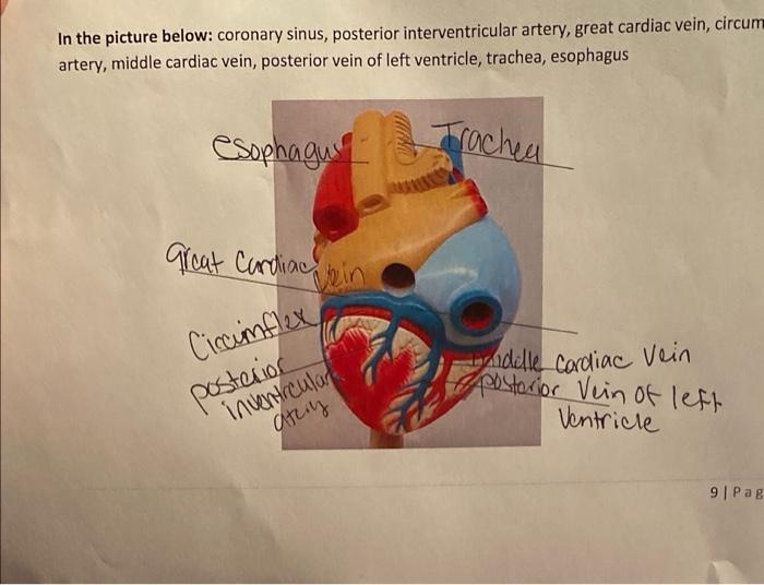 In The Picture Below Coronary Sinus Posterior Interventricular Artery Great Cardiac Vein Circum Artery Middle Cardi 1