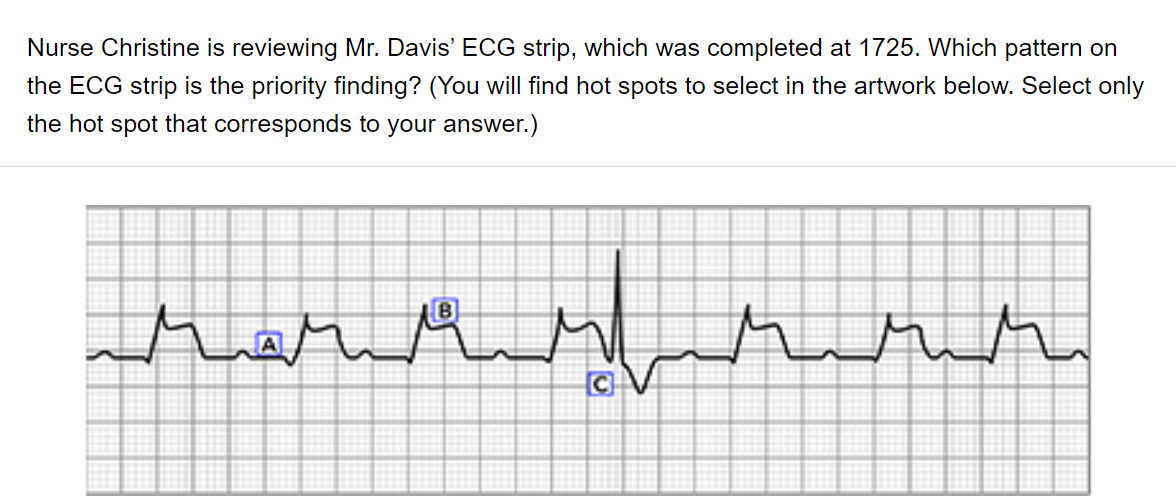 Nurse Christine Is Reviewing Mr Davis Ecg Strip Which Was Completed At 1725 Which Pattern On The Ecg Strip Is The Pr 1