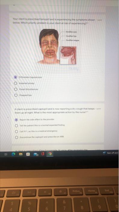 Your Client Is Prescribed Lisinopril And Is Experiencing The Symptoms Shown Below Which Priority Problem Is Your Client 1