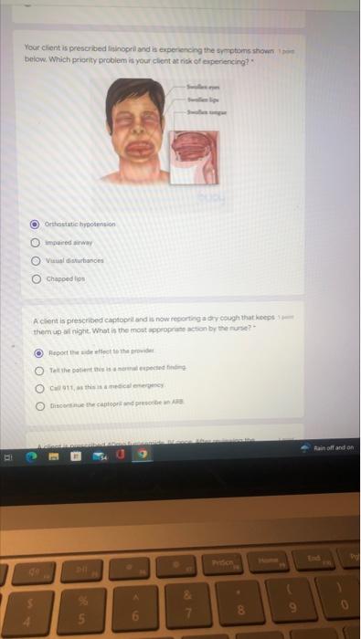 Your Client Is Prescribed Lisinopril And Is Experiencing The Symptoms Shown Below Which Priority Problem Is Your Client 1