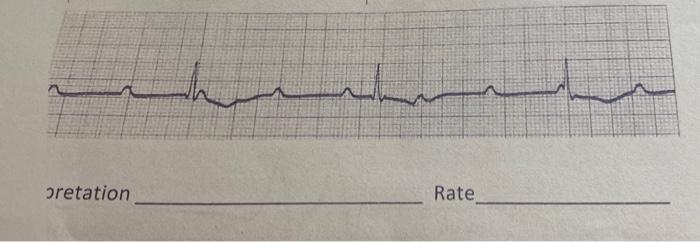 Pretation Rate 1