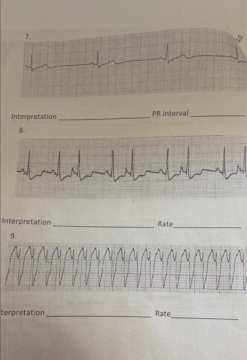 7 10 Interpretation Pr Interval 8 Der Interpretation Rate 9 Nn Innnnnnnnnnnnn Terpretation Rate 1