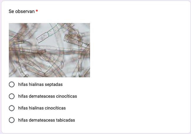 What Do We Observe A Septate Hyaline Hyphae B Cynocytic Demateaceous Hyphae C Coenocytic Hyaline Hyphae D Septate Demat 1