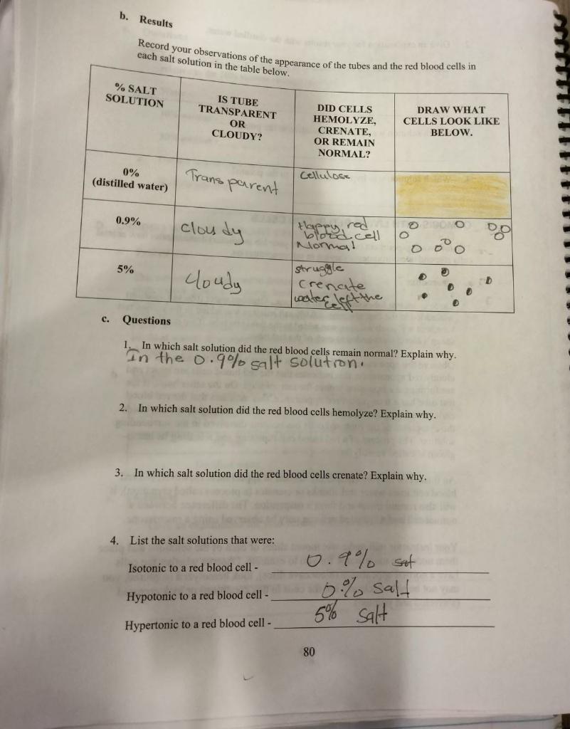 B Results Salt Solution C Record Your Observations Of The Appearance Of The Tubes And The Red Blood Cells In Each Sa 1