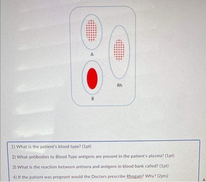 A B Rh 1 What Is The Patient S Blood Type 1pt 2 What Antibodies To Blood Type Antigens Are Present In The Patient S 1