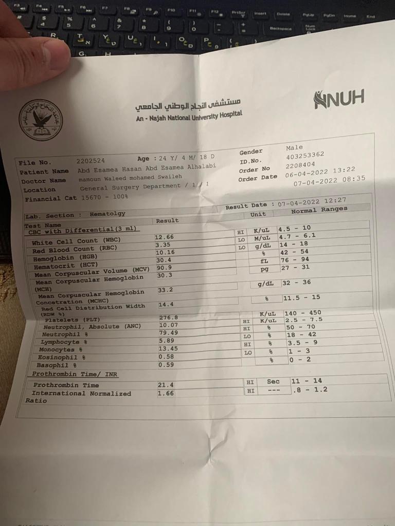 I Have A Patient Who Suffers From Aml M3 Post Ctx Respiratory Failure Pulmonary Hemorrhage And Atypical Pneumonia 1