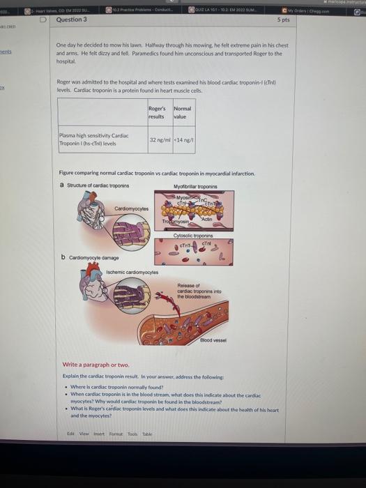 2x Hco Em 2022 Question 31 102 Pact Pre Conduc Plasma High Sensitivity Cardiac Troponin I Hs Ctnl Levels One Day He De 1