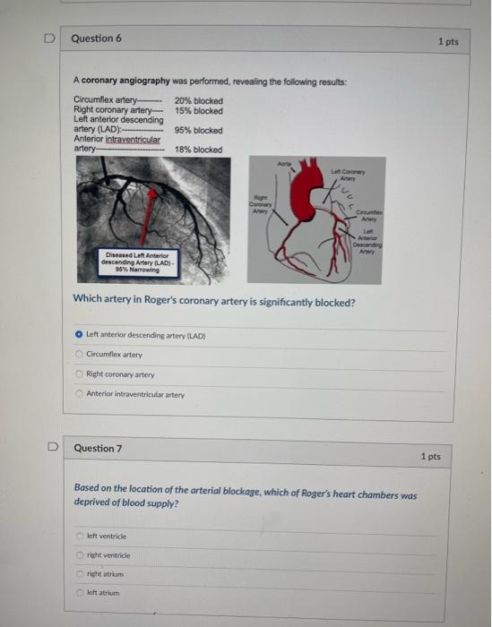 Question 6 A Coronary Angiography Was Performed Revealing The Following Results 20 Blocked 15 Blocked 95 Blocked 18 1