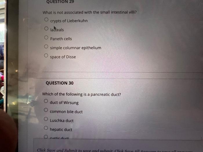 Question 1 Which Of The Following Is Noqproduced By Hepatocytes Albumins Prothrombin O Bile Lipoproteins Secretin Quest 15