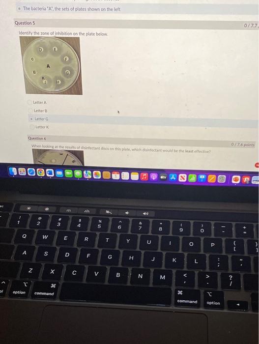 E 5 Question 5 Identify The Zone Of Inhibition On The Plate Below 1 The Bacteria A The Sets Of Plates Shown On The 1