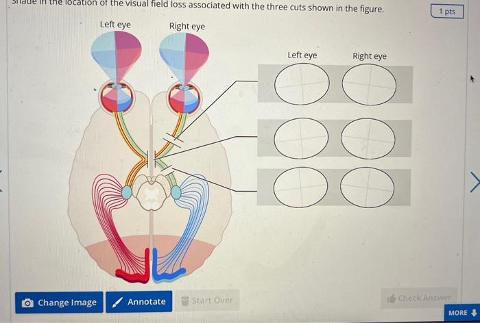 Order The Path Of Soundwaves From External Ear To The Vestibulocochlear Nerve Outer Ear Cochlea External Acoustic Meatu 3