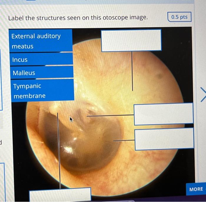 D Label The Structures Seen On This Otoscope Image External Auditory Meatus Incus Malleus Tympanic Membrane 0 5 Pts Mor 1
